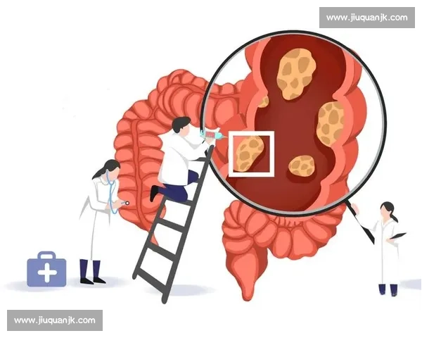 直肠癌早期筛查与治疗进展及预后管理策略研究